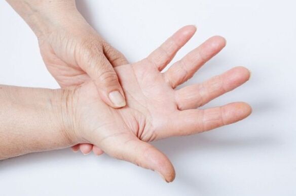 Здранцвенне рук - адзін з сімптомаў паяснічнага астэахандрозу